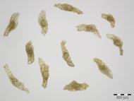 Samen vom Breitblättrigen Knabenkraut (Dactylorhiza majalis) Foto: M. Cubr, Botanischer Garten und Botanisches Museum Berlin Samen vom Breitblättrigen Knabenkraut (Dactylorhiza majalis) Foto: M. Cubr, Botanischer Garten und Botanisches Museum Berlin